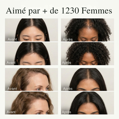 Le soin solide coréen YO-RI
